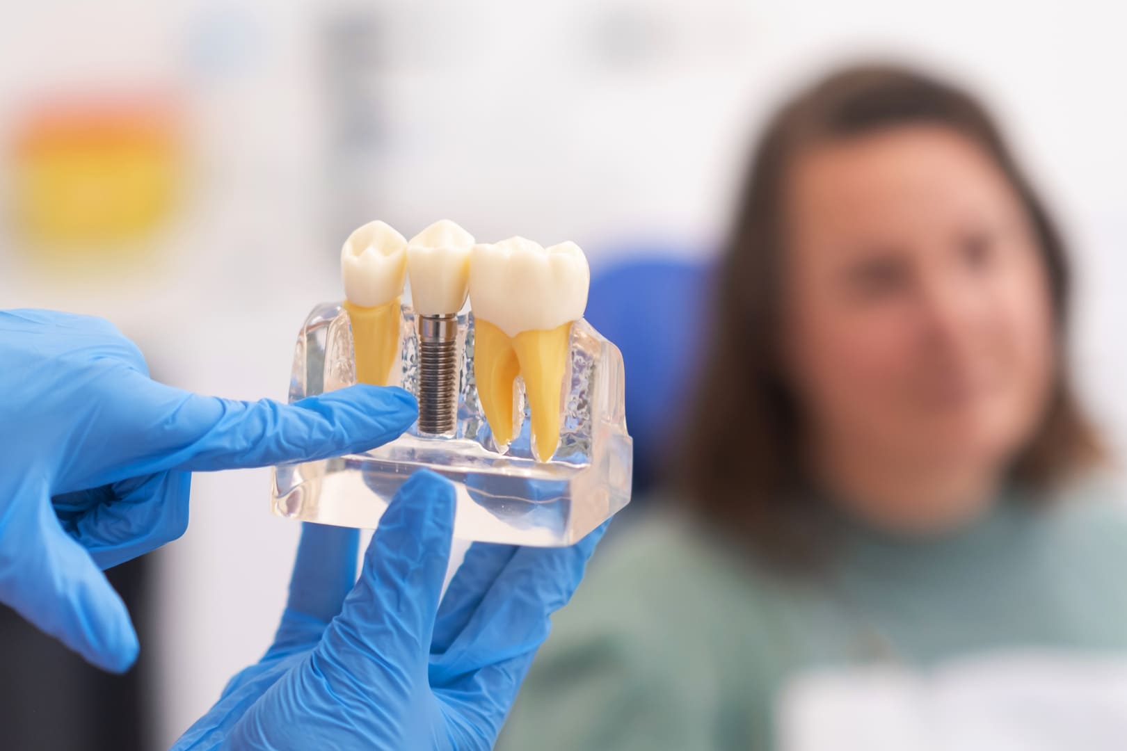 Dentiste expliquant le traitement implantaire à un patient à Nice