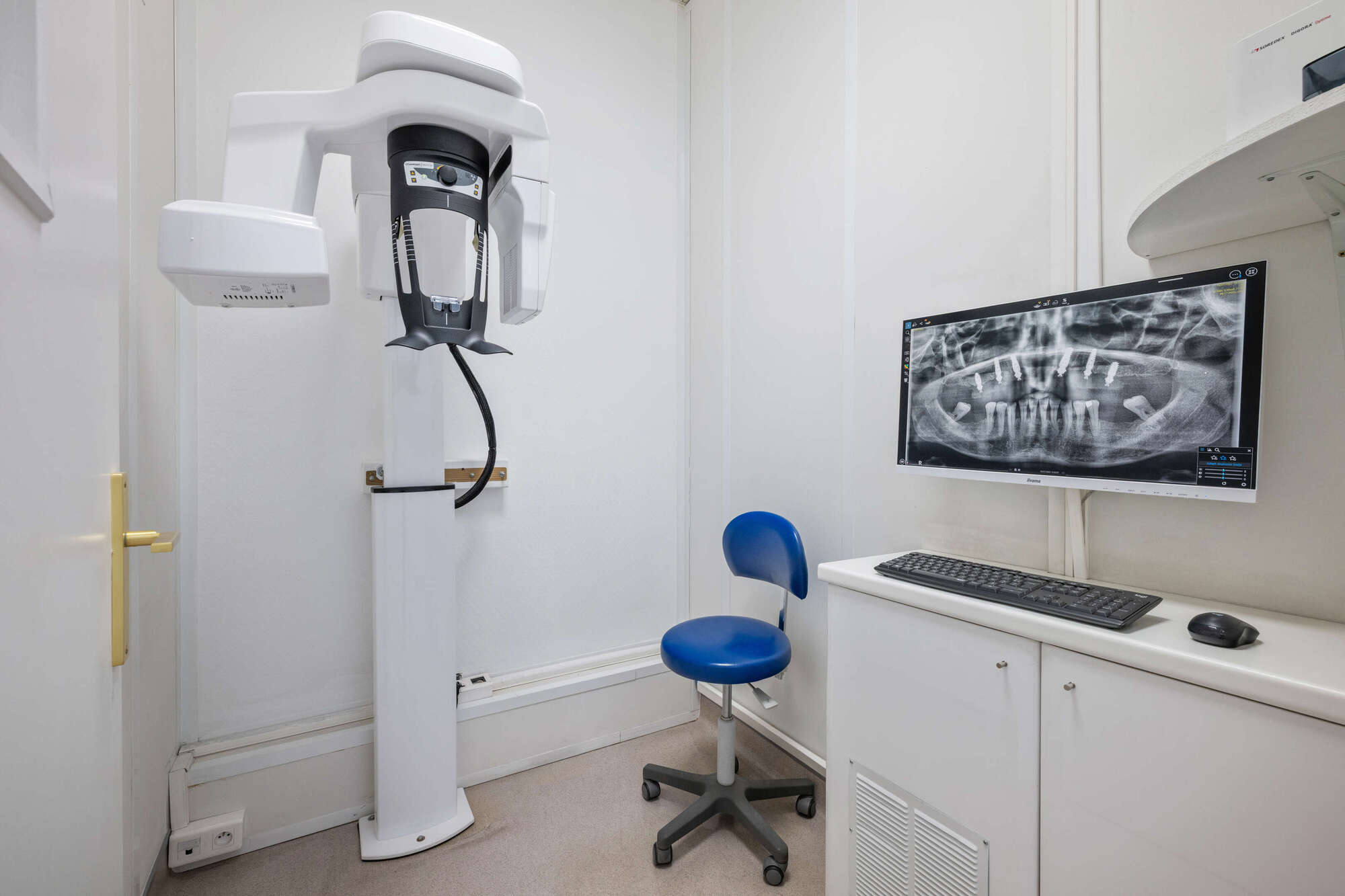 Radiographie panoramique numérique implants dentaires cabinet Charbit Nice